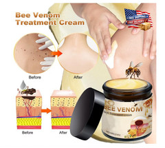 Bee Venom All-In-One Cream Skin Treatment 2026 Professional Bee Venom Cream 60g
