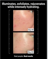 FAST SHIPPING!!! Allies of Skin Multi Acids &Retinoid Brightening Facial 1.7oz