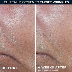 RoC Retinol Firming Serum Stick & Retinol Eye Cream for Visibly Tighter Skin