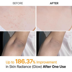 Peel Shot Kojic Acid Turmeric Body Exfoliator Spray 6.76 Fl.Oz – AHA PHA Niacina