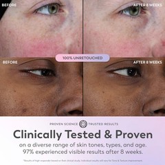Olay Super Serum – Glow for Face – Activated 1 Fl Oz (Pack of 1)
