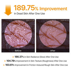 Peel Shot Kojic Acid Turmeric Body Exfoliator Spray 6.76 Fl.Oz – AHA PHA Niacina