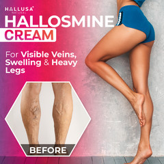 2 pack Hallosmine cream + Free Hallosmine Ultra Diosmin, Vein support supplement