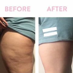 Anti Cellulite Massage Oil-Tones Skin & Breaks Down Fat Tissue (60ml) 2 oz