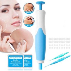 Painless Auto Skin Tag Remover Kit for Small & Large Skin Tags