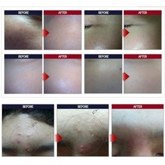 1+1 Best Whitening Cream 100g + Best Snail Cream 100g Moisturizing Korea Cosmeti