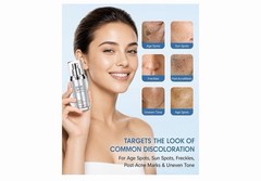 TJE Dark Spot Corrector Face Serum Niacinamide Paraben-Free 1.06 oz/30 ml