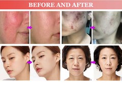 Skin Whitening Home Use Skin Rejuvenation Anti Aging Wrinkle Beauty Face Machine