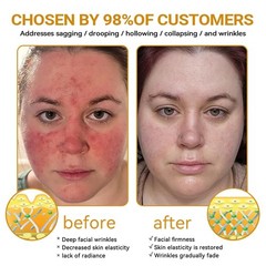 VLSVLS Bee Venom skin Treatment Cream, Improved Firming & Wrinkle-Reducing cream