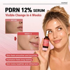 CELDYQUE Salmon DNA PDRN Anti-Aging Serum 1 Fl Oz – Hydrating & Repairing