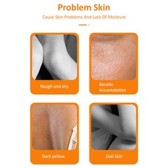 MOOYAM 100ml Orange Peeling Lotion Peeling Oil Body Lotion Gentle N7U1