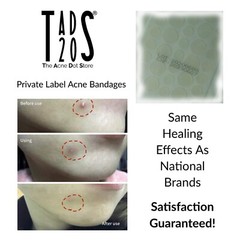 5pk [160] Acne Dot Pimple Patches [TEA TREE] SMALL/LARGE Cystic Acne Spot Dots