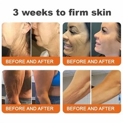 VLSVLS Bee Venom skin Treatment Cream, Improved Firming & Wrinkle-Reducing cream