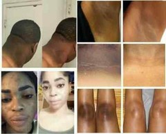 2 X Dark Skin Bleaching Cream Whitening Lightening AHA – Face & Body |- 15g