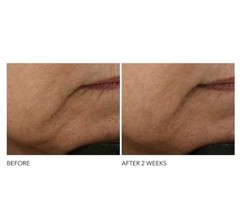NEW Dr Dennis Gross Advanced Retinol + Ferulic Intense Wrinkle Cream 2 Oz/ 60mL