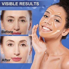 Anti Wrinkle Face Tape | Skin for Wrinkles | Facial Myofascial Beige