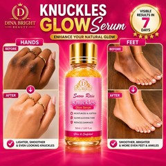 Knuckles Glow Serum 100ml For Dark Knuckles Hands Feet Uneven Skin Tone