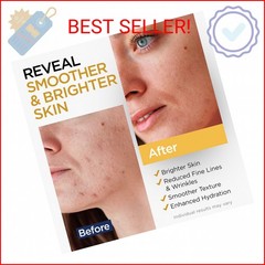 Vitamin C Serum for Face with Stem Cells Hyaluronic Acid Aloe Vera Vitamin E Ant